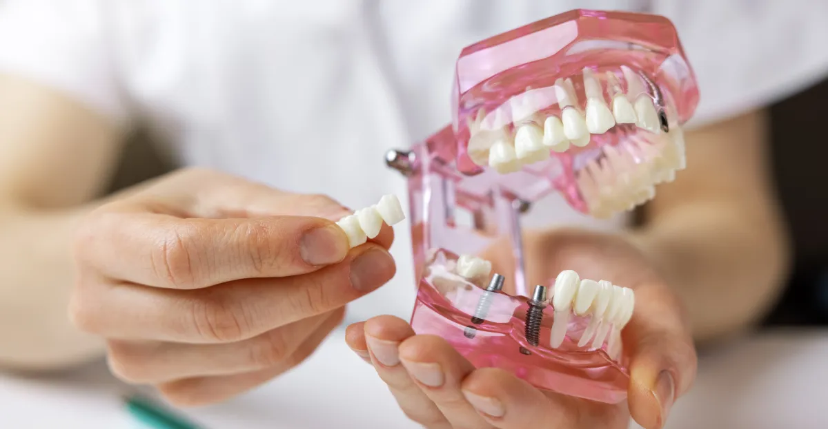 Dental Implants in Stone Oak: Restoring Your Smile